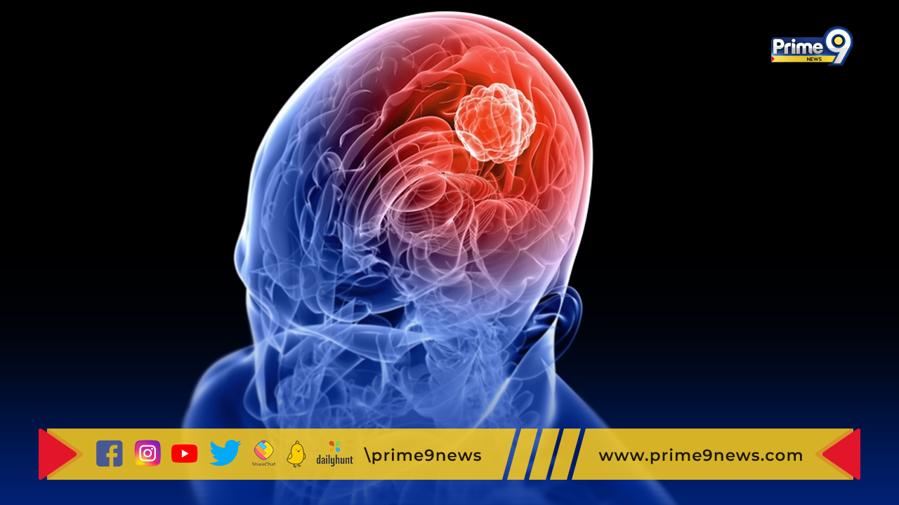 Brain Tumor : బ్రెయిన్ ట్యూమర్ పై స్పెషల్ స్టోరీ..  ఏపీలో అందుబాటులో ఉన్న అత్యాధునిక వైద్యప్రక్రియలు